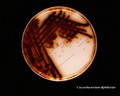 corynebacterium diphtheriae